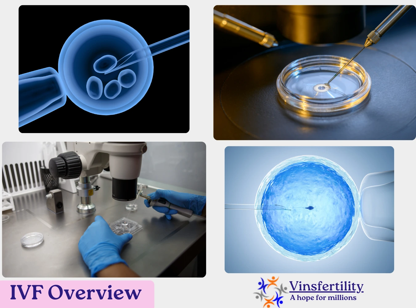 IVF Overview For Guaranteed IVF in Gurugram | IVF cost in Gurugram