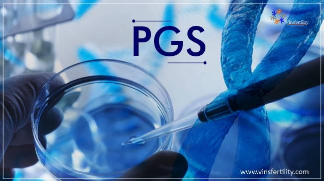 Preimplantation Genetic Screening (PGS)